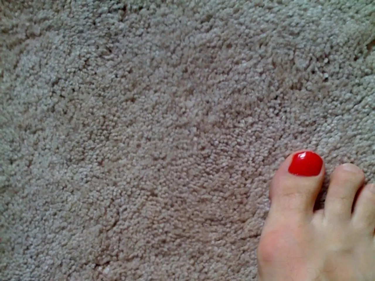 "Spoon Nails and Curved Tips/Sides: Understanding the Root Causes"