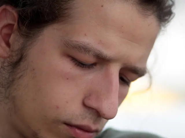 Endoscopic Facelift: Information, Signs, and Remedies